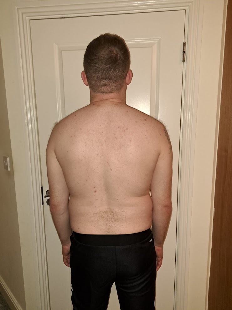 Keith before - photo 1